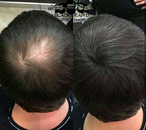 Hair Growth Cream Stronger Hair Fuller-Looking Hair regrowth, Men & Women regrowth