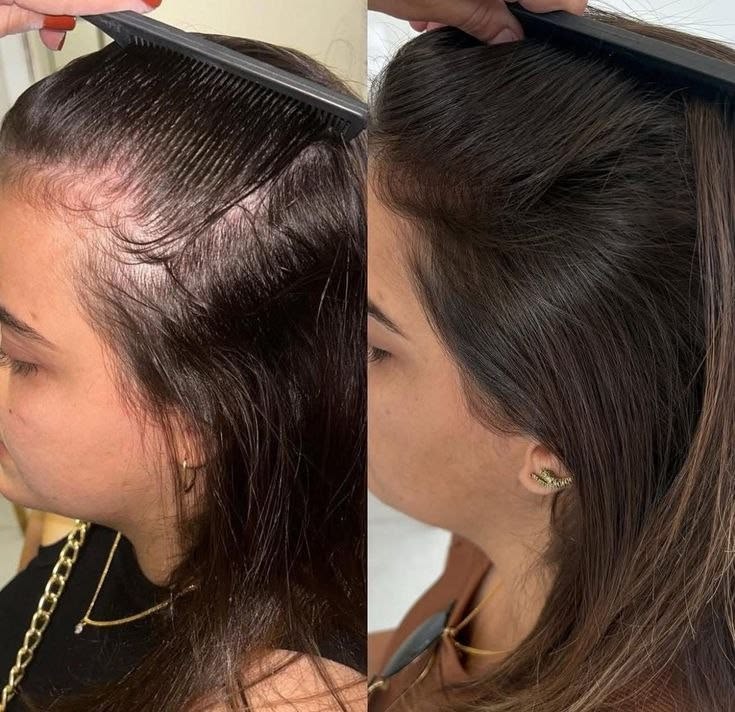 Hair Growth Cream Stronger Hair Fuller-Looking Hair regrowth, Men & Women regrowth